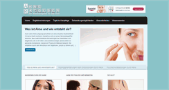 Desktop Screenshot of akne-ratgeber.org